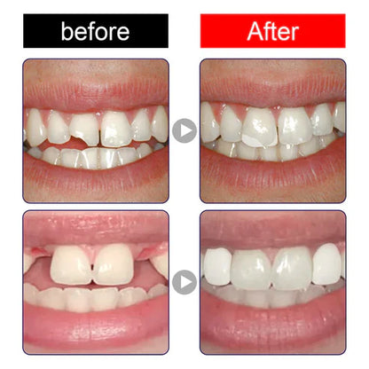 2X1 DentalPro™ SONRISA PERFECTA AL INSTANTE